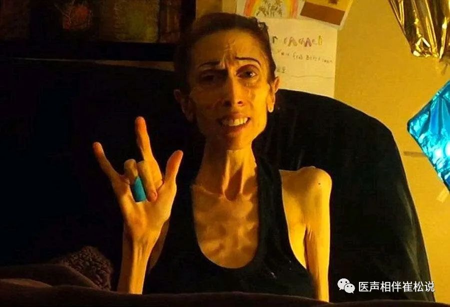 骨瘦如柴电影,小巷深处的隐藏瑰宝