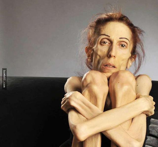 厌食症明星的自然美景治愈之旅