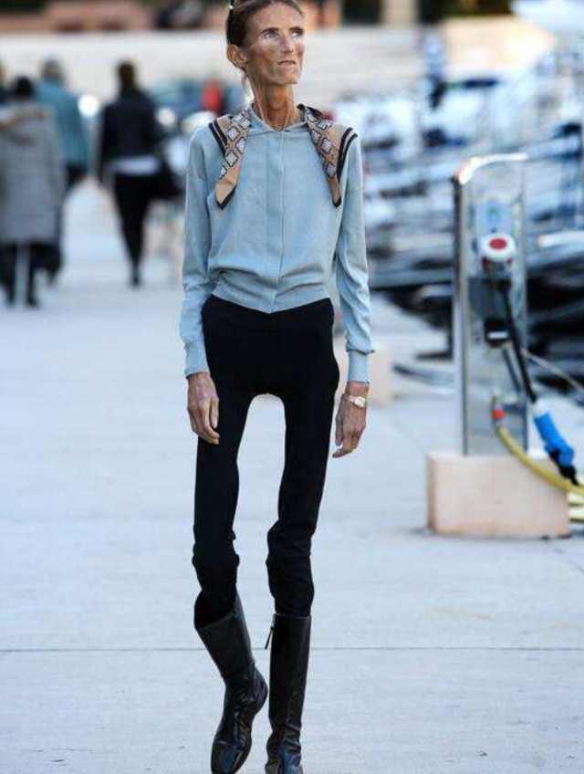 厌食症明星的自然美景治愈之旅