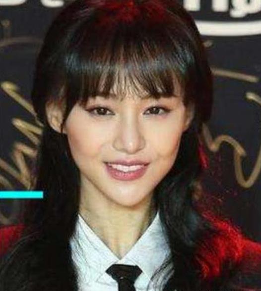 郑爽完成取出假体手术,最新动态与观点论述